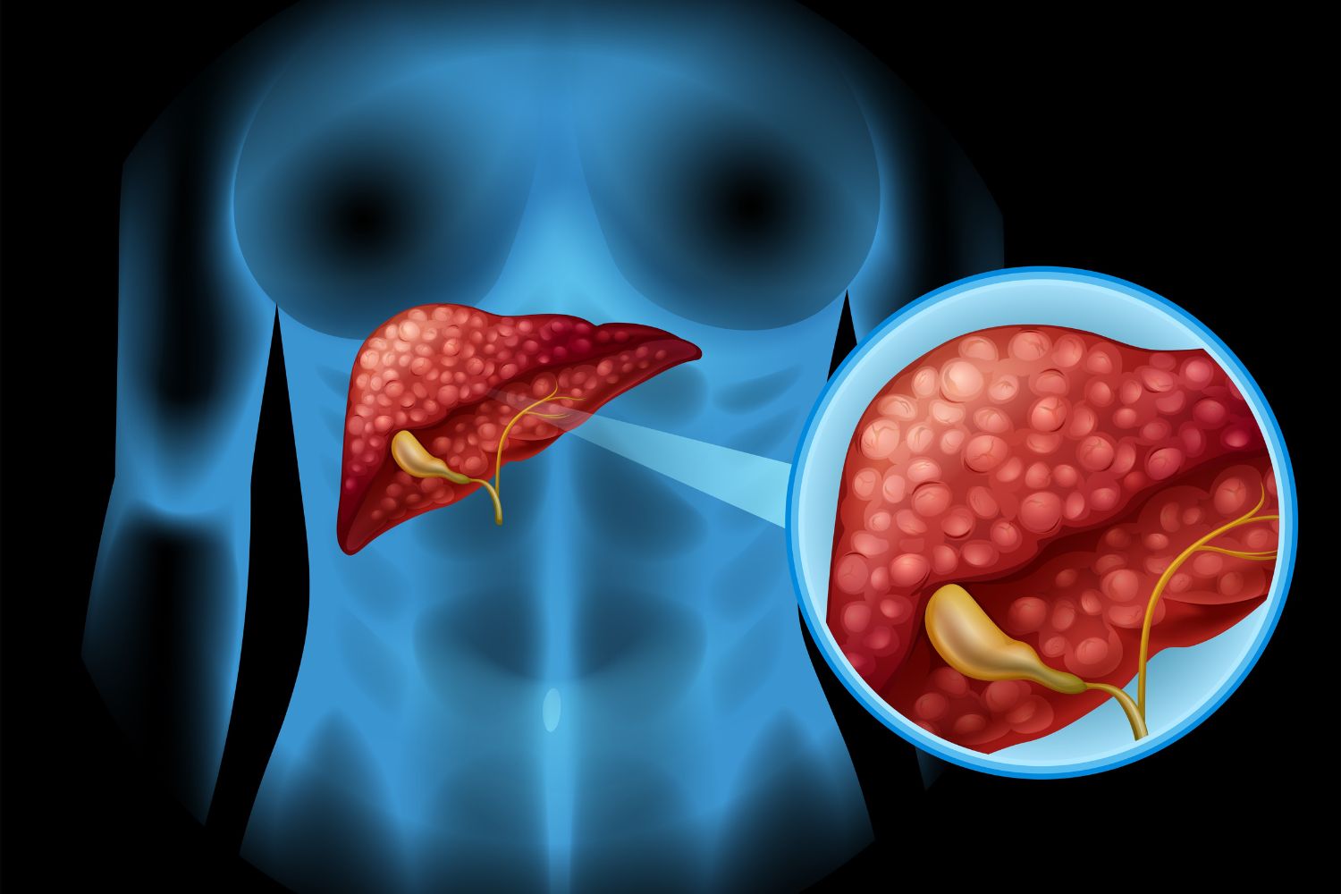 liver regeneration