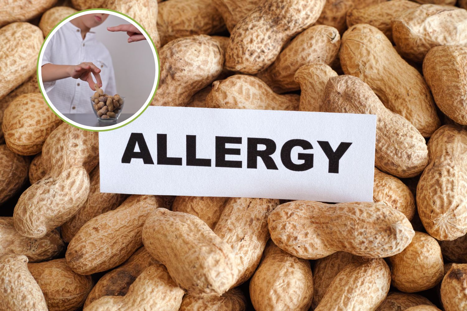 allergia arachidi