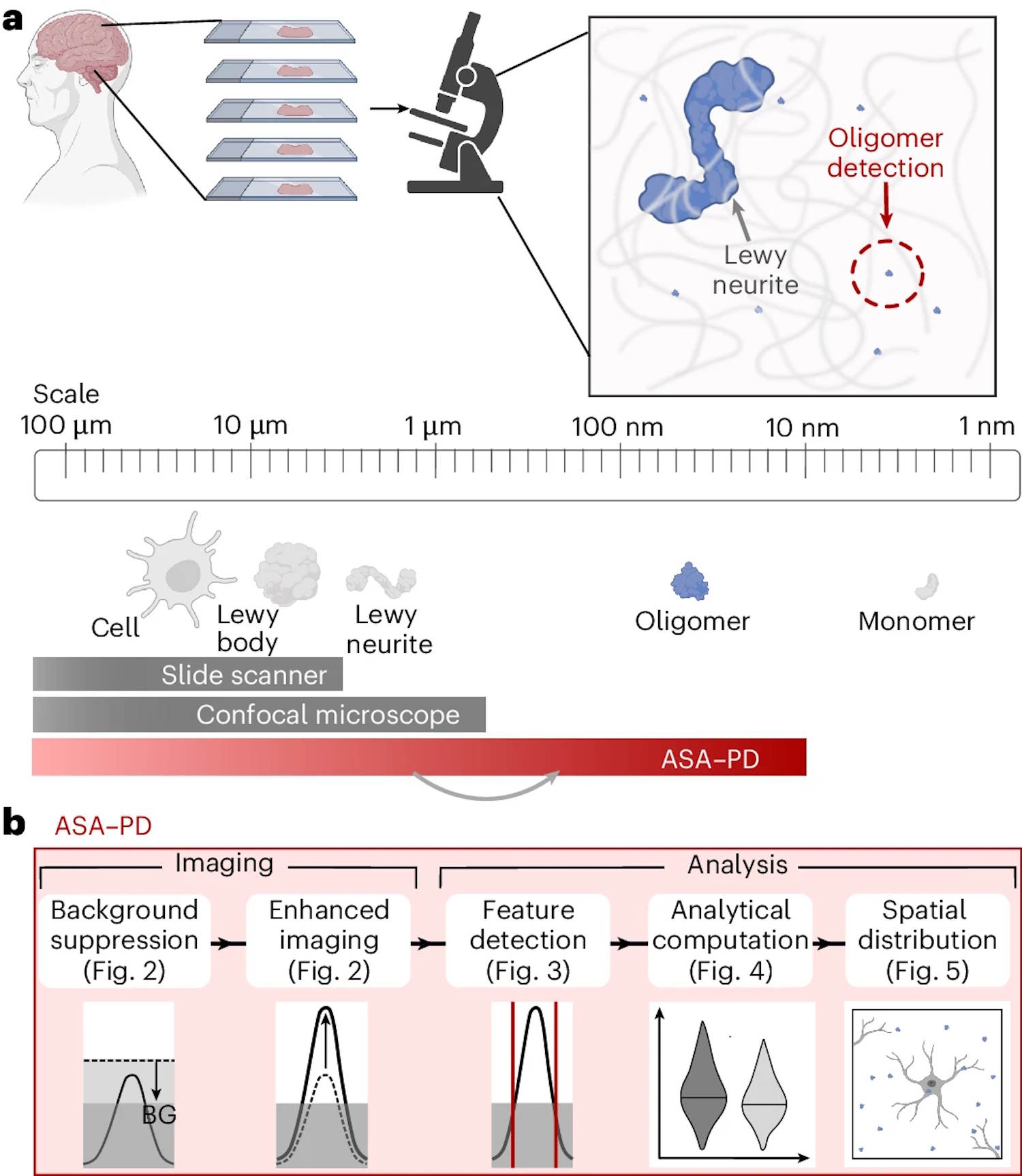 parkinson's disease images protein clusters cause