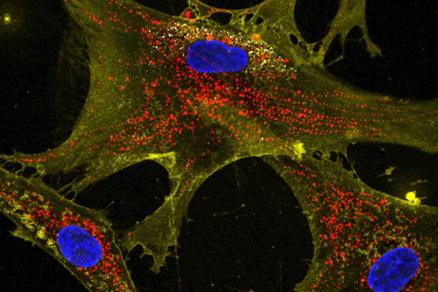 cellule contro invecchiamento