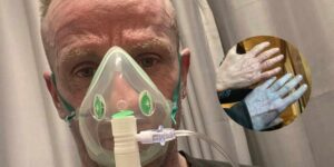 He wakes up with blue skin like an Avatar and rushes to the hospital, then finds out why (hilarious)