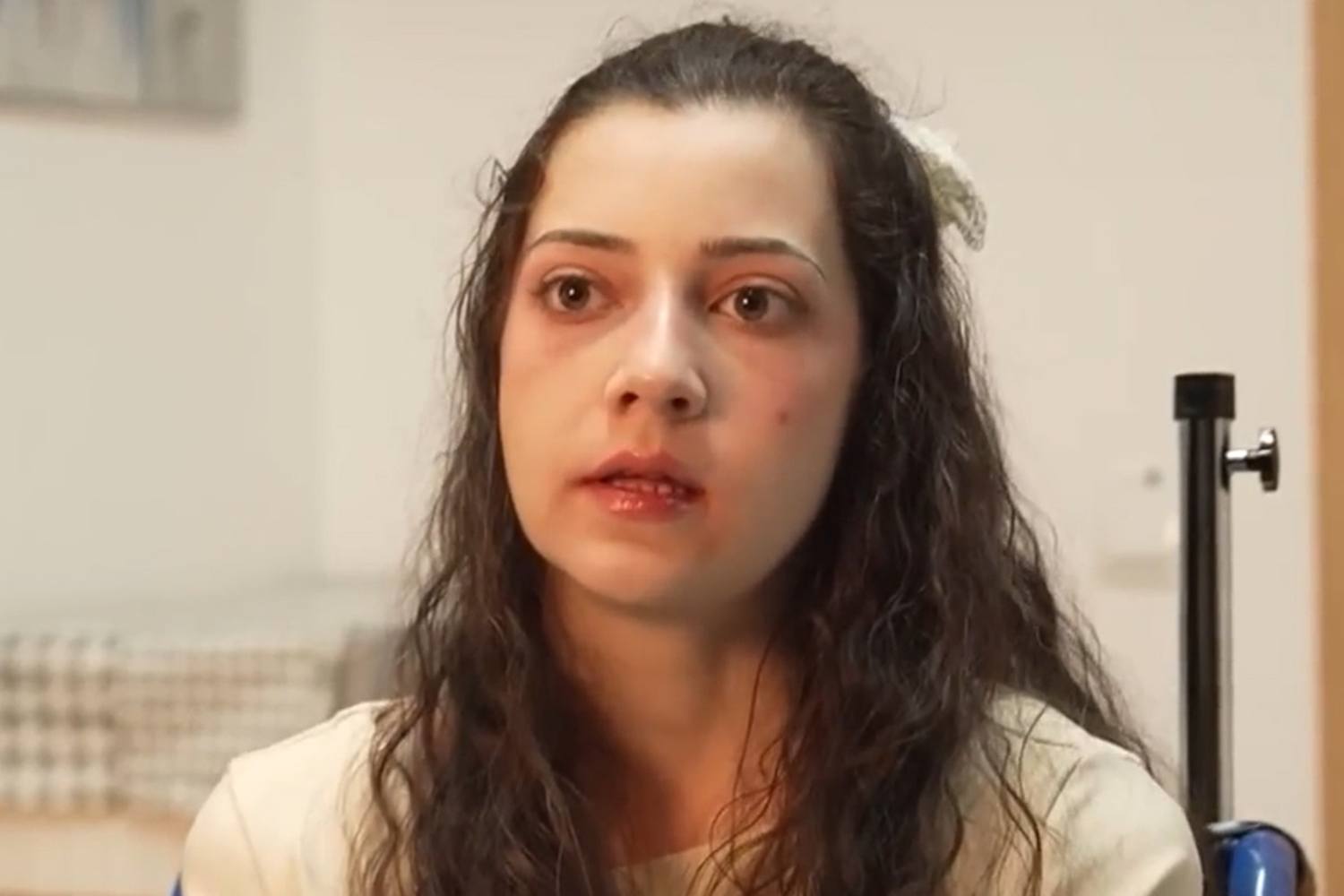 Died by euthanasia at 25 years old: the choice of Noelia, who was paralyzed due to an attempted suicide after having suffered sexual violence