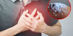 Microplastics: there are many more in the blood of those who have had a heart attack, according to the new Italian study
