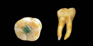 The Mayans already knew how to fill teeth in an accurate and… precious way!