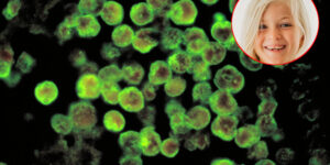 8-year-old girl dies after swimming in the lake due to brain-eating amoeba: what it is and where it is found