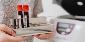 Breakthrough for Alzheimer’s: blood test from age 40 for those who already have symptoms, green light in the USA