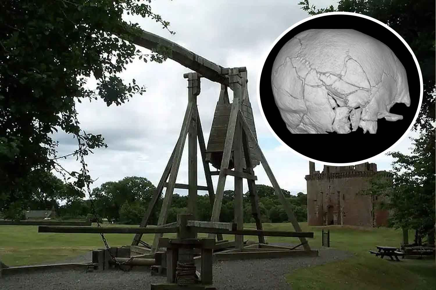 scheletro con 167 fratture trovato a Stirling