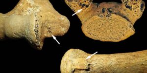 Buried as a man: 7,000-year-old grave proves flexible gender roles existed as early as the Neolithic